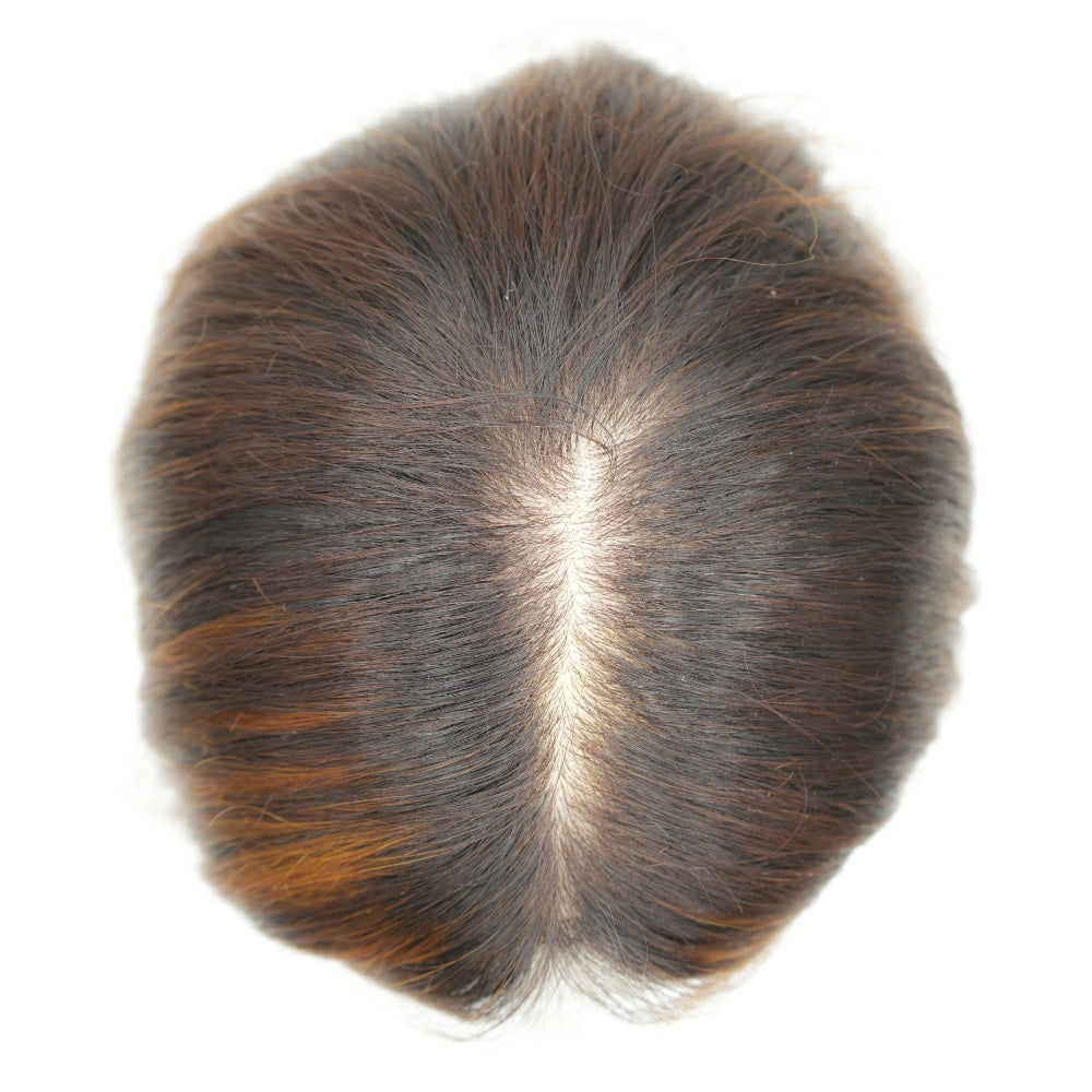 Dettaglio cute naturale - base dermica invisibile e traspirante, parrucca capelli veri dispositivo medico detraibile